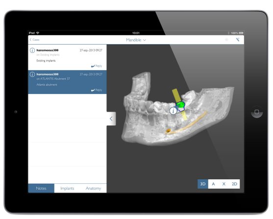 A preview of SIMPLANT software on an iPad.